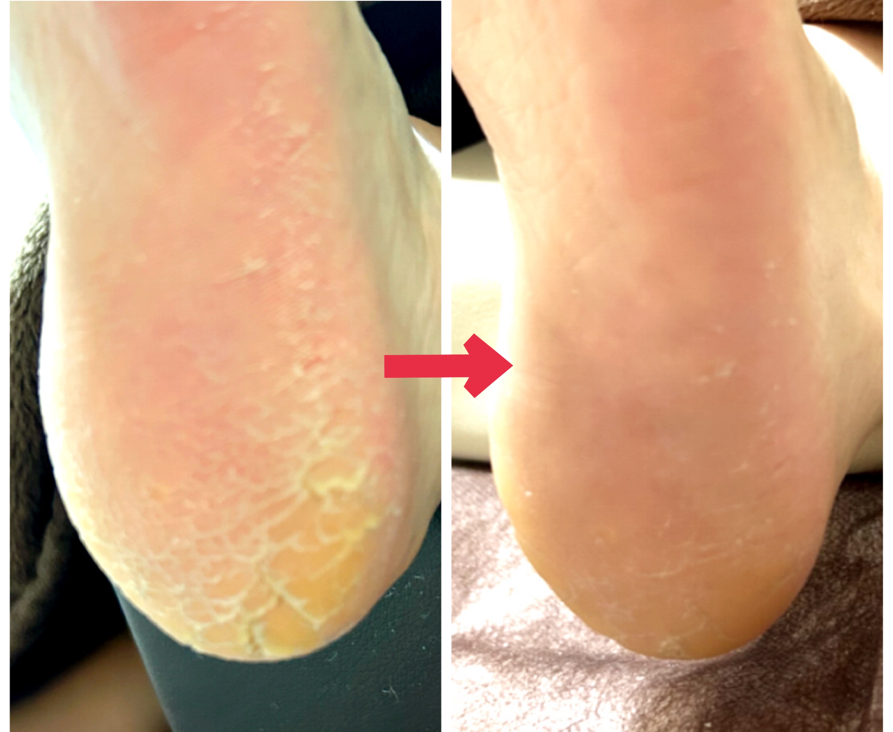 ネイルケアゆりの紹介写真_4枚目